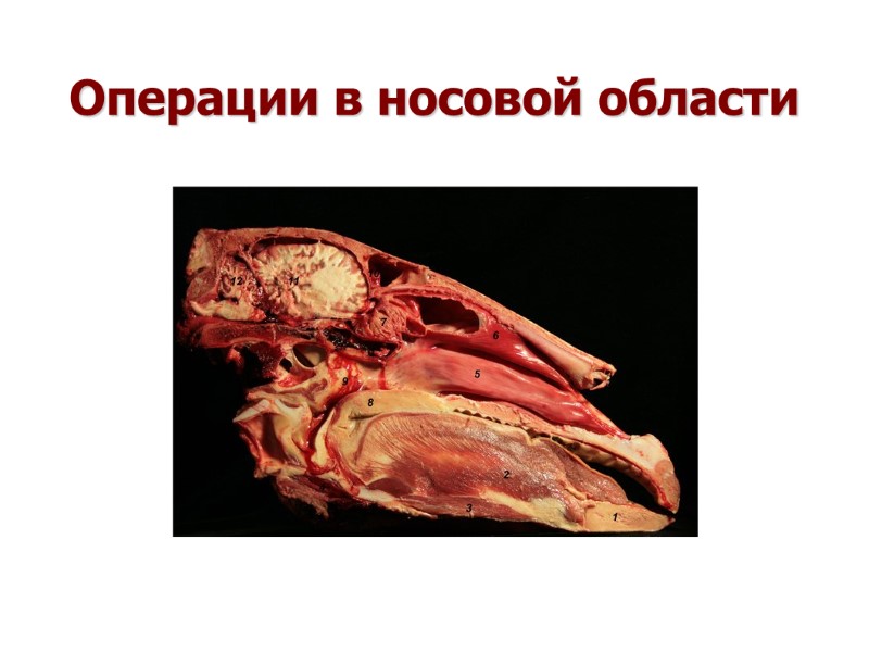 Операции в носовой области Операции в носовой области